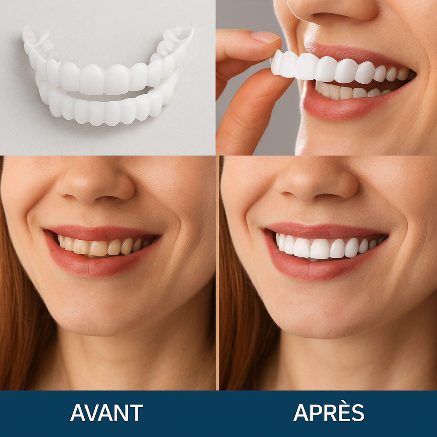Facettes Dentaires BilSmile